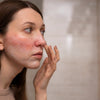 Retinol Purging of Irritatie: Waarom je soms eerst puistjes krijgt van Vitamine A