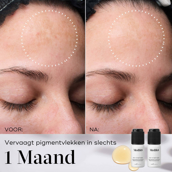 Medik8 Oxy-R Peptides | Serum Tegen Pigmentvlekken