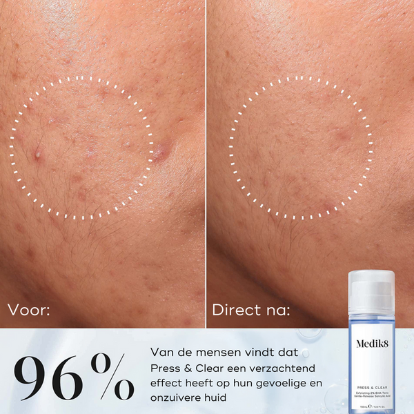 Medik8 Press & Clear | Milde Salicylzuur Toner tegen Onzuiverheden